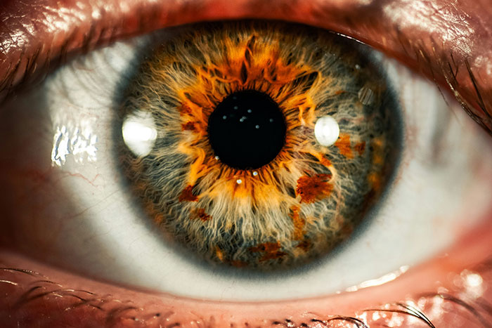 Close-up of a human eye with intricate orange patterns, showcasing fascinating details of the iris.