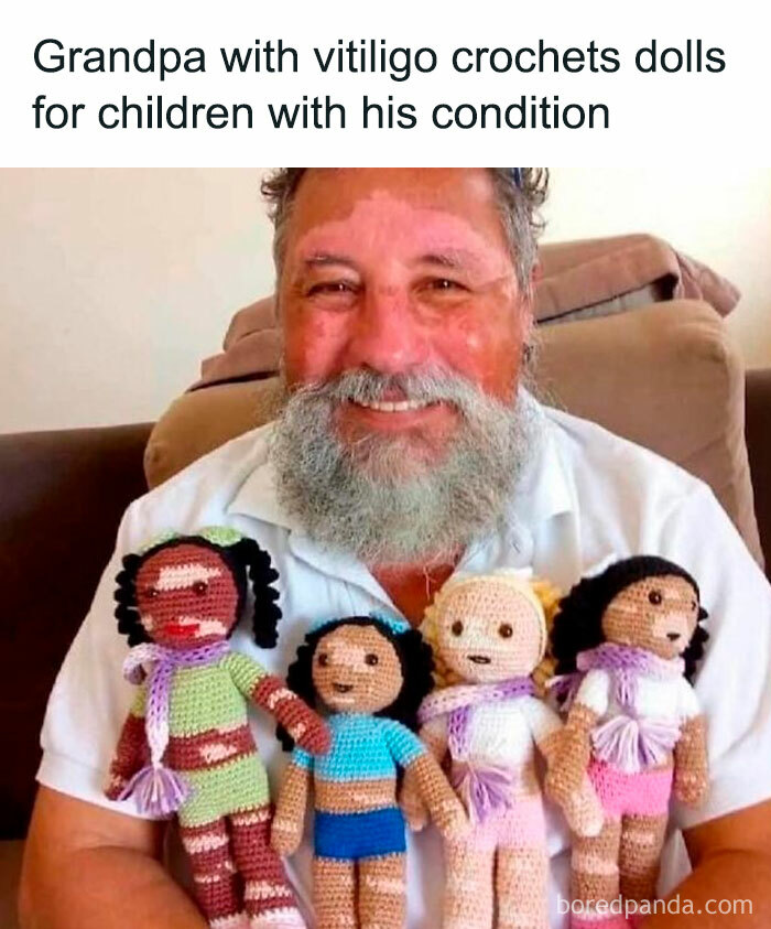 Smiling grandpa with vitiligo holding crocheted dolls matching his skin condition, showcasing wholesome memes kindness.