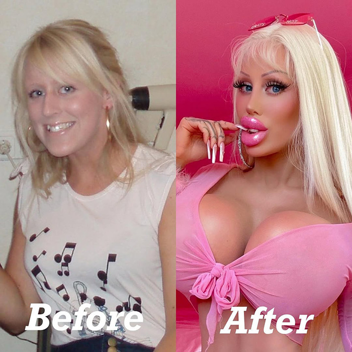 Woman's transformation into Barbie after $120k makeover, showcasing before and after images.