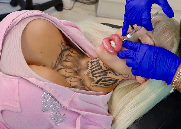 Woman undergoing cosmetic procedure to look like Barbie, getting injection by a professional in gloves.