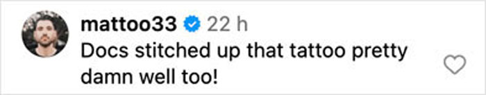 Comment from Pink's husband on a stitched-up tattoo in a post-surgery picture after bike accident displayed on social media.