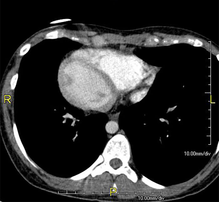 Imagen de tomografía computarizada mostrando hallazgos extraños y singulares según expertos en autopsias.