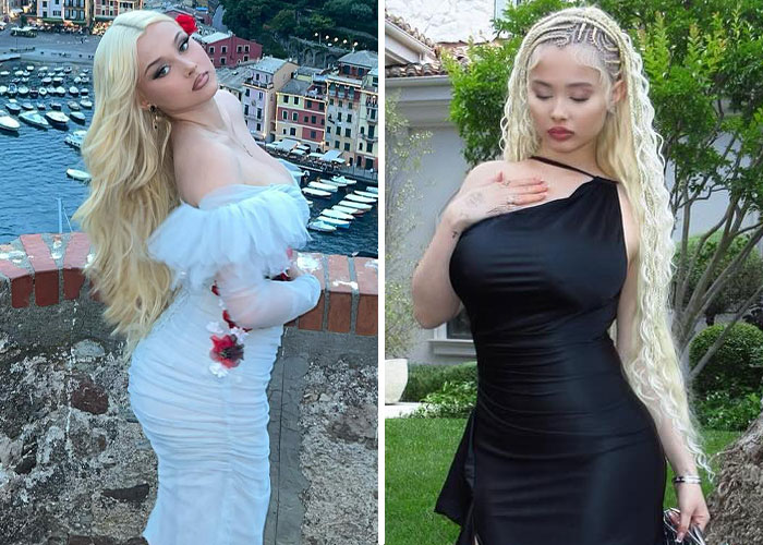 Alabama Barker poses in elegant dresses during a photoshoot, sparking reactions related to weight-loss medication. Alabama Barker poses in elegant dresses during a photoshoot, sparking reactions related to weight-loss medication.