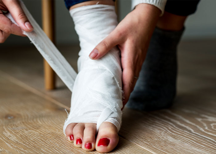 50 People Share Their Injuries That Are Not Funny But You Can’t Help But Laugh