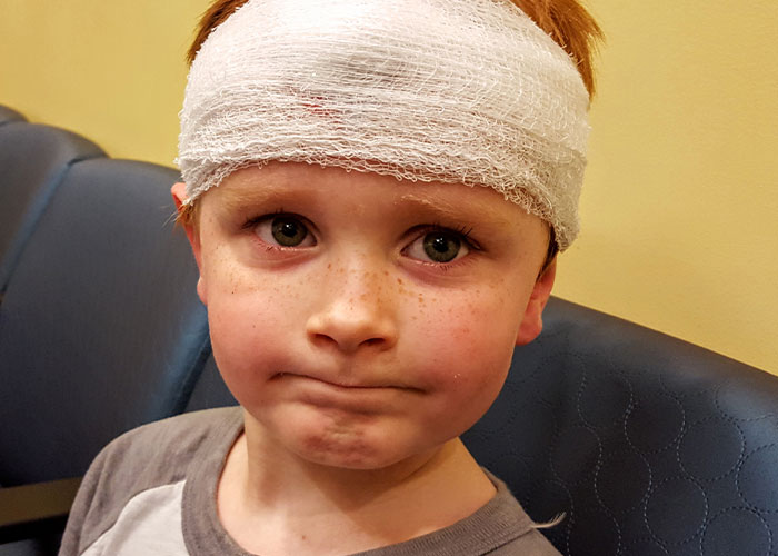 50 People Share Their Injuries That Are Not Funny But You Can’t Help But Laugh