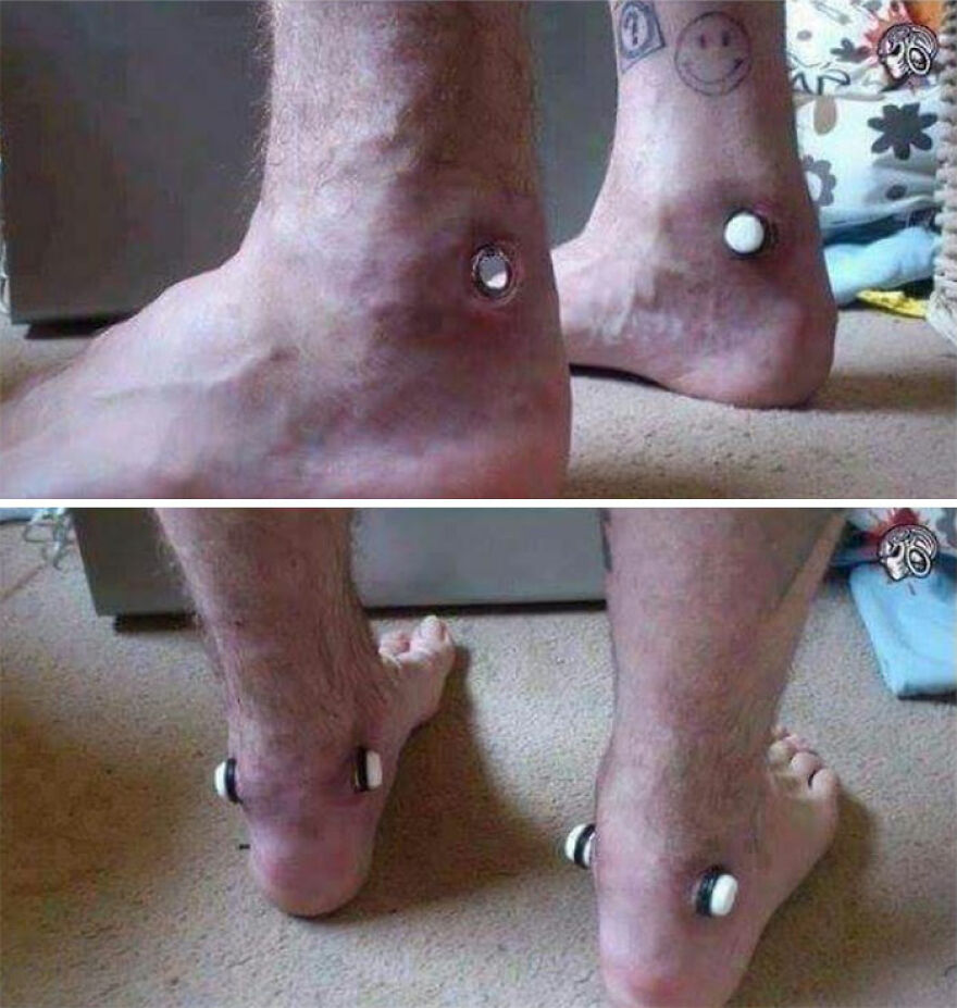 Close-up of feet with bizarre medical body modifications showing unusual piercings on the ankles and heels.