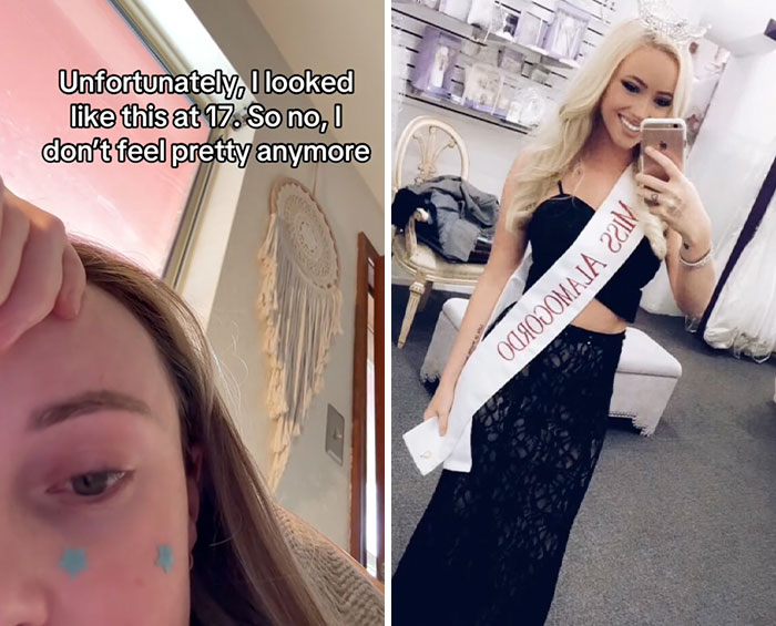 Side-by-side photos of a young woman showing a glow down trend transformation with text overlay on the left.