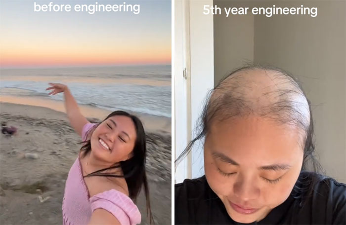 Before and after pics of engineering student showing youthful happy face at beach and stressed look with hair loss in fifth year.
