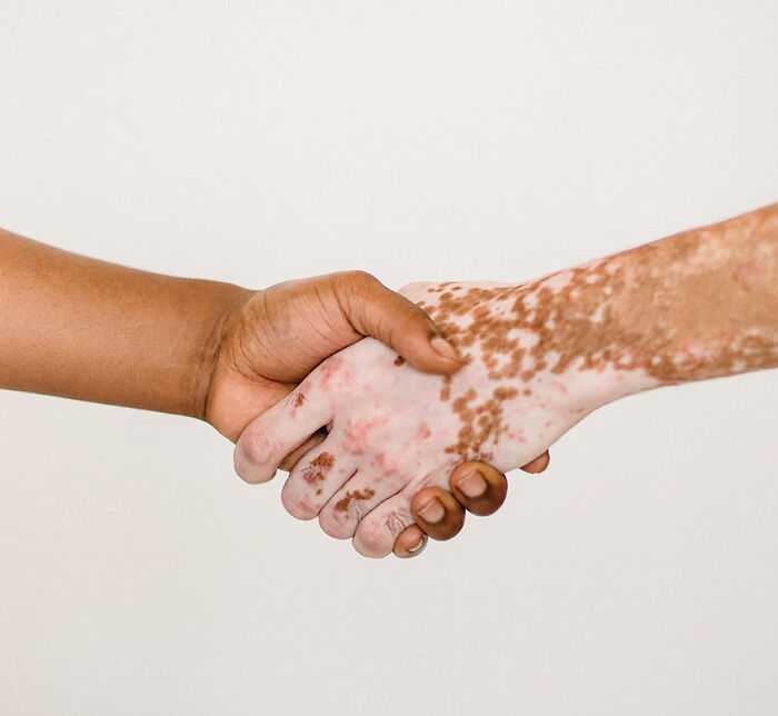 “What’s One Hill That Others May Not Agree With But That You Will Die On?” (37 Answers)