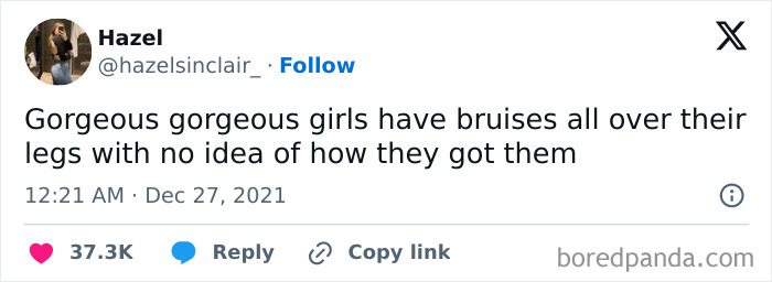 Tweet by Hazel mentioning girls with bruises on their legs, featured in relatable posts to make your day better about smile today cry tomorrow.