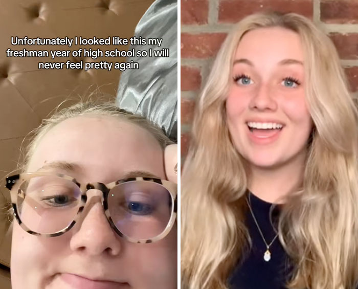 Young woman sharing her glow down transformation with before and after photos showing the people glow downs trend.