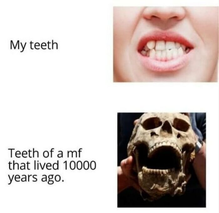 Close-up of human teeth compared to ancient skull teeth shown humorously in chaotic memes about life boredom.
