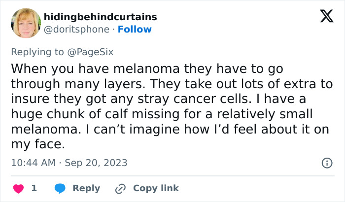 Comment discussing the challenges of melanoma surgery and the removal of extra tissue to prevent cancer cells spreading. Comment discussing the challenges of melanoma surgery and the removal of extra tissue to prevent cancer cells spreading.