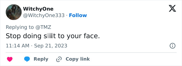 Screenshot of a social media comment criticizing Khloe Kardashian's plastic surgery with unsettling stitched appearance. Screenshot of a social media comment criticizing Khloe Kardashian's plastic surgery with unsettling stitched appearance.