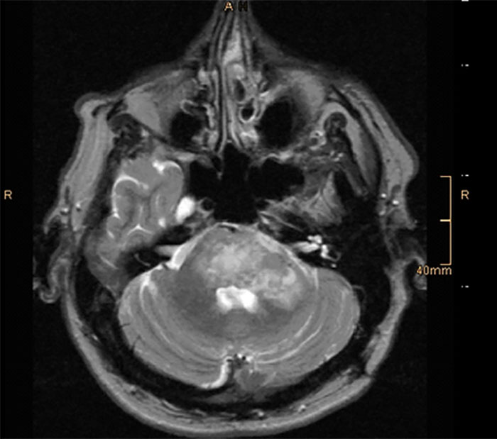 MRI scan showing unexpected anomalies in the skull during bizarre and unexpected discoveries found during autopsies.