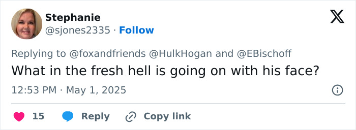 Tweet from Stephanie questioning Hulk Hogan&rsquo;s troubling new look at 71, focusing on his eyes and facial changes.