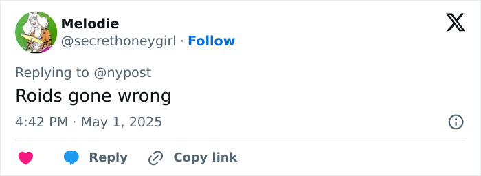 Screenshot of a Twitter comment by Melodie responding to @nypost referencing Hulk Hogan&rsquo;s troubling new look at 71.