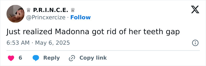 Tweet text on a social media post stating Madonna got rid of her teeth gap, surprising fans about the missing facial feature.