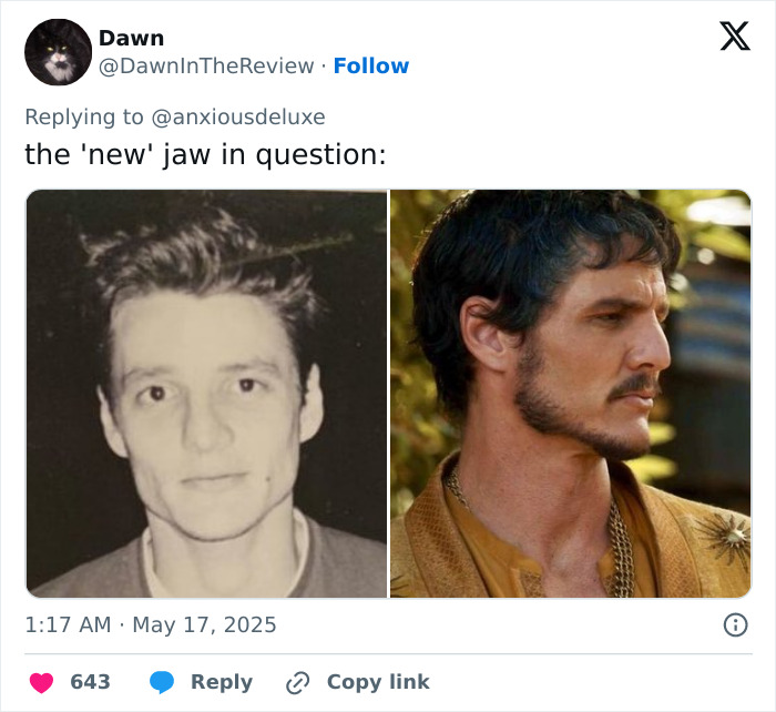 Side-by-side photos comparing Pedro Pascal’s jawline, sparking debate over plastic surgery or Ozempic effects. Side-by-side photos comparing Pedro Pascal’s jawline, sparking debate over plastic surgery or Ozempic effects.