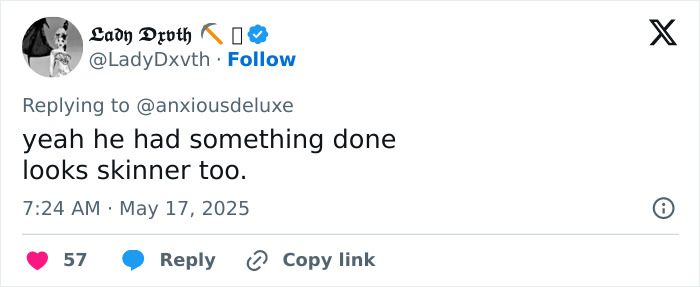 Twitter reply about Pedro Pascal’s new jaw, speculating if it’s plastic surgery or Ozempic causing a skinnier look. Twitter reply about Pedro Pascal’s new jaw, speculating if it’s plastic surgery or Ozempic causing a skinnier look.