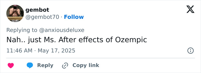Tweet discussing Pedro Pascal’s new jaw, fans guessing if it’s plastic surgery or effects of Ozempic. Tweet discussing Pedro Pascal’s new jaw, fans guessing if it’s plastic surgery or effects of Ozempic.