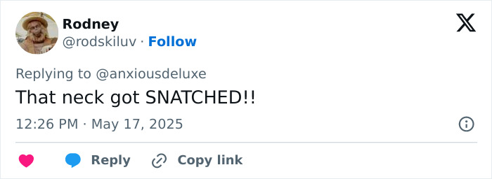 Tweet from Rodney commenting on Pedro Pascal’s new jaw, sparking fan guesses about plastic surgery or Ozempic. Tweet from Rodney commenting on Pedro Pascal’s new jaw, sparking fan guesses about plastic surgery or Ozempic.