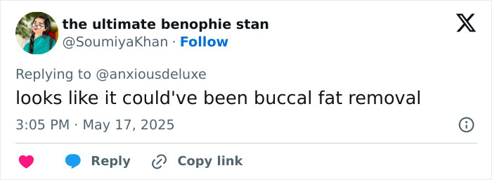 Tweet mentioning buccal fat removal in discussion about Pedro Pascal’s new jaw and plastic surgery or Ozempic speculation. Tweet mentioning buccal fat removal in discussion about Pedro Pascal’s new jaw and plastic surgery or Ozempic speculation.