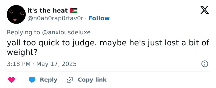 Tweet from user replying about Pedro Pascal’s new jaw, suggesting he may have lost weight amid plastic surgery or Ozempic rumors. Tweet from user replying about Pedro Pascal’s new jaw, suggesting he may have lost weight amid plastic surgery or Ozempic rumors.