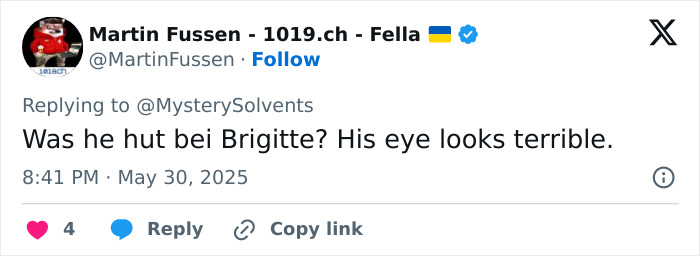 Tweet screenshot showing concern about Elon Musk&rsquo;s black eye and head tics raising glitching worries at the White House.