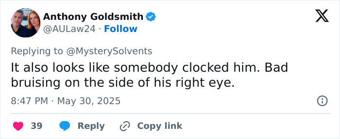 Tweet discussing concerns about Elon Musk's black eye and head tics after White House appearance, highlighting bruising near eye.