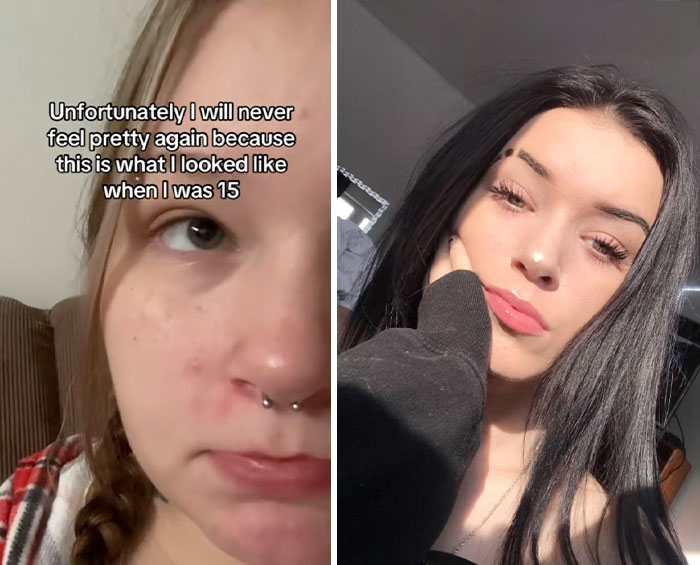 Side-by-side photos showing a woman's glow down transformation highlighting the people share glow downs trend.