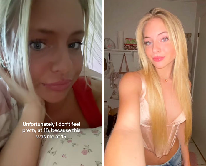 Side-by-side photos of a young woman showing a glow down, sharing her experience with the glow downs trend.