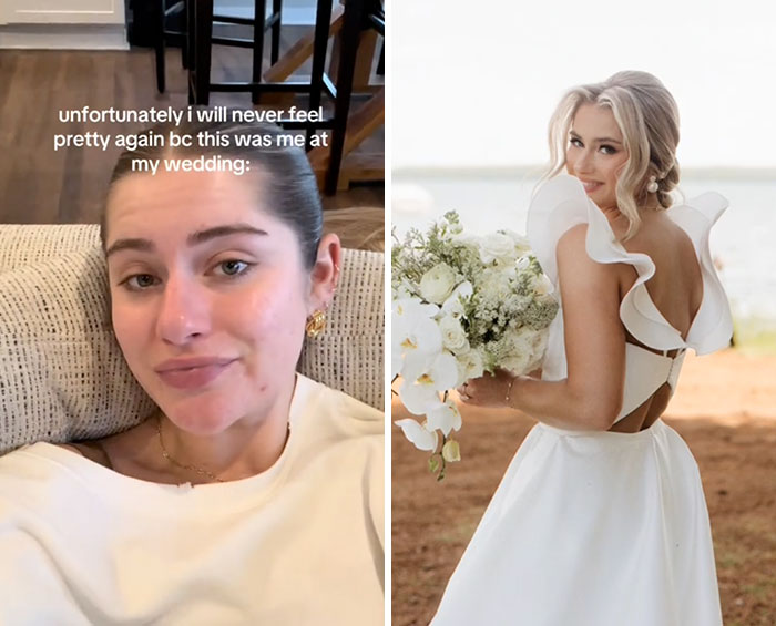 Side-by-side images showing a woman embracing the glow downs trend with a casual selfie and a wedding photo in a white dress.