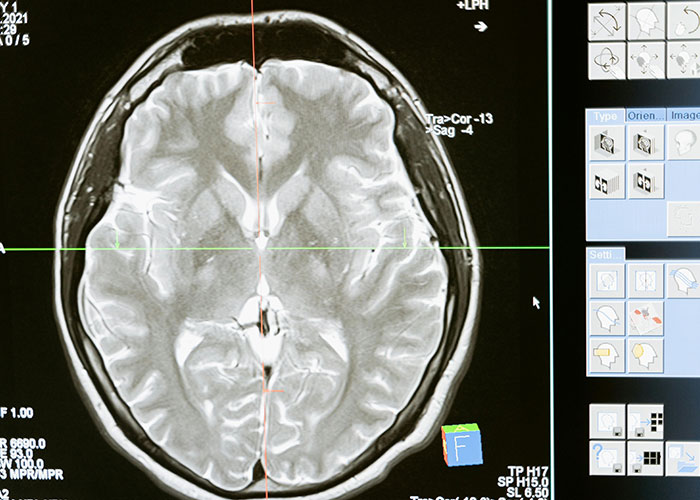 MRI brain scan image showing detailed gray and white matter structures with medical interface for entertaining facts content.