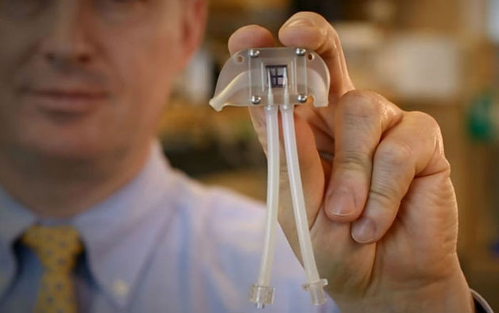 Experto en autopsias sostiene una herramienta médica con tubos, revelando hallazgos extraños y singulares.