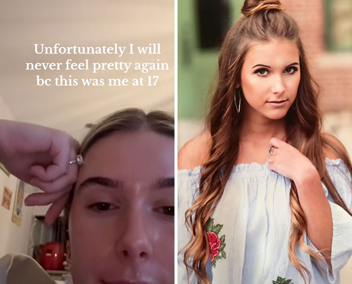 Split image showing a young woman at 17 on the right and a current photo on the left sharing a glow downs trend.