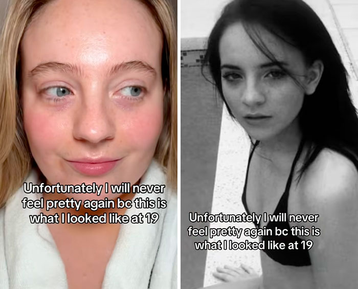 Side-by-side photos of a young woman sharing her experience with the glow downs trend at age 19.