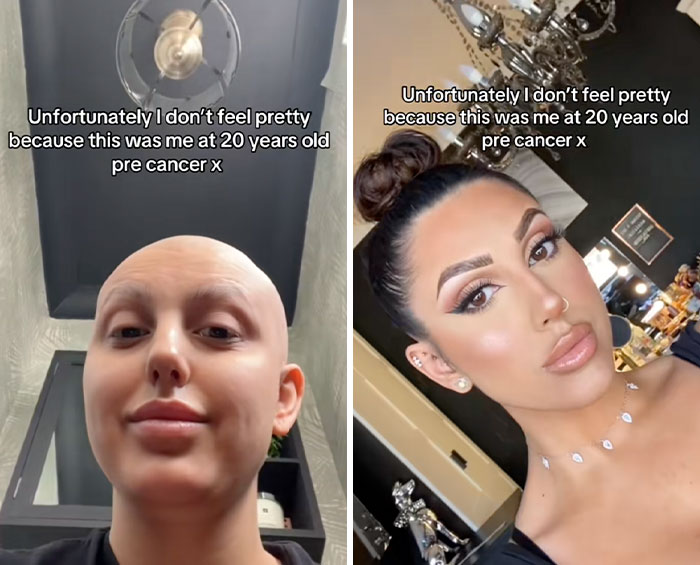 Side-by-side photos showing a woman before and after cancer treatment, illustrating the People Share Glow Downs trend.