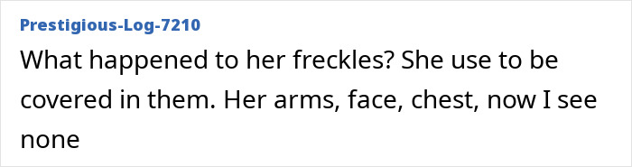 Lindsay Lohan stuns in new ad with a fresh look, noticeably missing her signature freckles on face and arms.