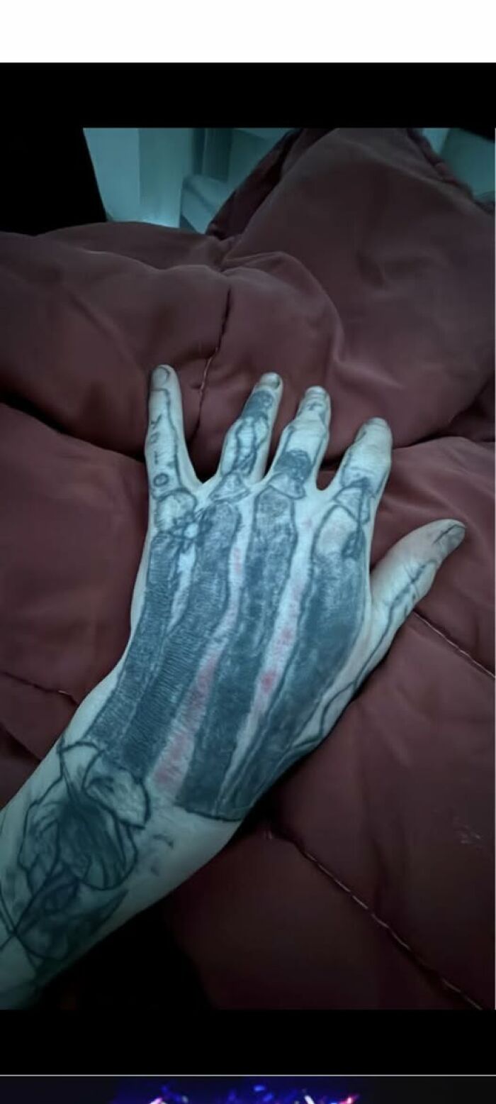 Hand tattoo resembling bones and joints, an example of people getting inked to look cool but with a permanent mistake.