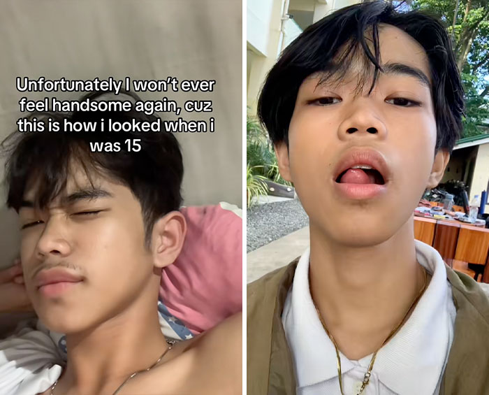 Young man sharing his glow down transformation with side-by-side photos highlighting the glow downs trend.