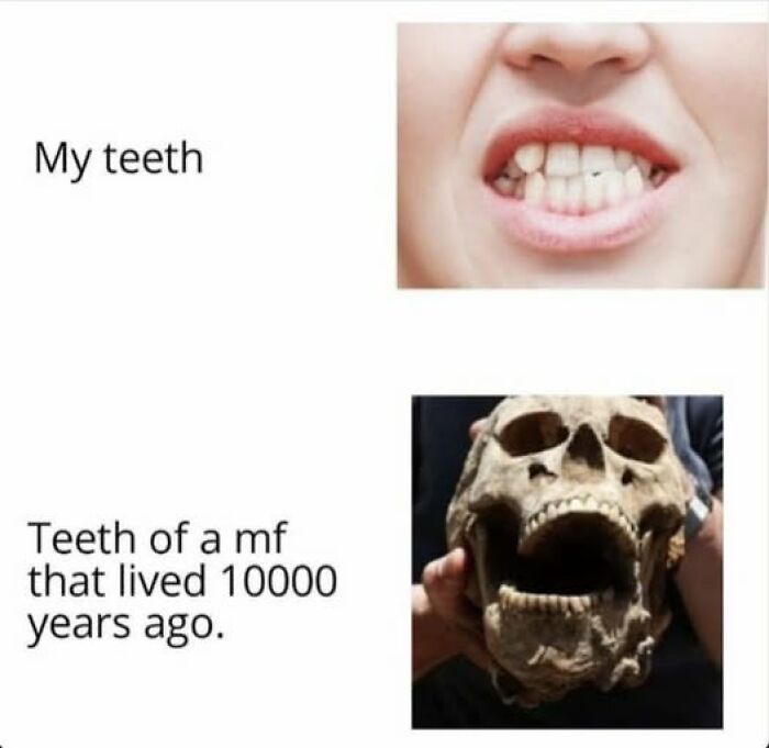 Close-up of human teeth next to ancient skull teeth comparing modern and prehistoric dental structure vegan memes.