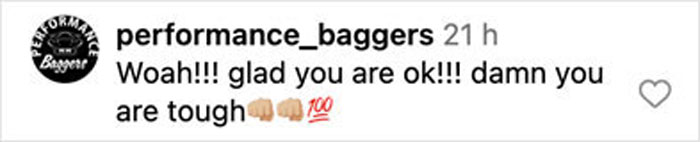 Comment from performance_baggers expressing relief and admiration for toughness after bike accident and surgery.