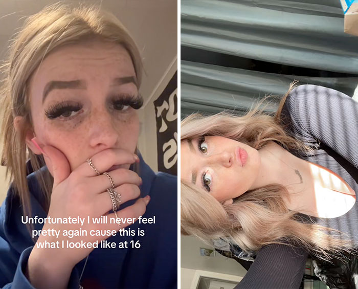 Young woman sharing her glow downs trend with side-by-side photos showing changes over time in natural light.