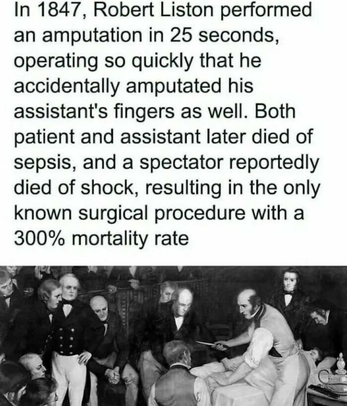 Historic image showing Robert Liston performing a rapid amputation with a surgical team, a secret fact in medical history.