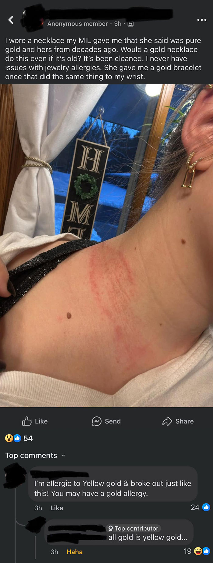 Online group shames overconfident know-it-alls with red skin rash from gold necklace allergy correction debate