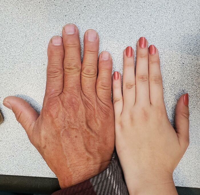 Left and right hands of different ages side by side, illustrating one-in-a-million coincidences and unique similarities.