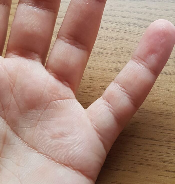 Close-up of a hand displaying unique fingerprints, an example of one-in-a-million coincidences hard to believe.