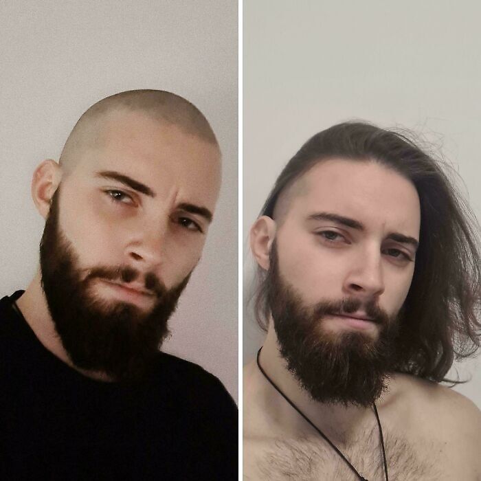 Side-by-side hair transformation of a man showing a buzz cut and long hair with a full beard, highlighting hair transformations.