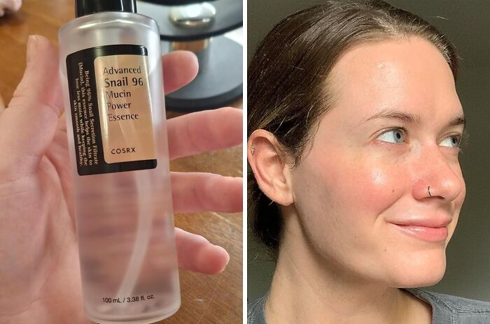 Hand holding a bottle of skincare essence beside a woman showing glowing skin, popular bestseller product for skincare enthusiasts.